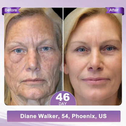 𝑶𝒇𝒇𝒊𝒄𝒊𝒂𝒍 𝑺𝒕𝒐𝒓𝒆| 𝐋𝐚𝐝𝐲𝐬𝐜𝐚𝐫𝐭® 𝐏𝐃𝐑𝐍 𝐌𝐮𝐥𝐭𝐢-𝐏𝐞𝐩𝐭𝐢𝐝𝐞 𝐌𝐚𝐬𝐬𝐚𝐠𝐢𝐧𝐠 𝐁𝐨𝐝𝐲 𝐑𝐨𝐥𝐥𝐞𝐫 𝐂𝐫𝐞𝐚𝐦-Anti-aging, Hydrating, Skin Firming & Lifting, Skin Repair, Even Tone, Acne and Dark Spot Treatment, Wart and Mole Removal, and Psoriasis Relief