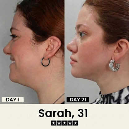 Hoygi Silhouette Refiner Double Chin Lifting Mask