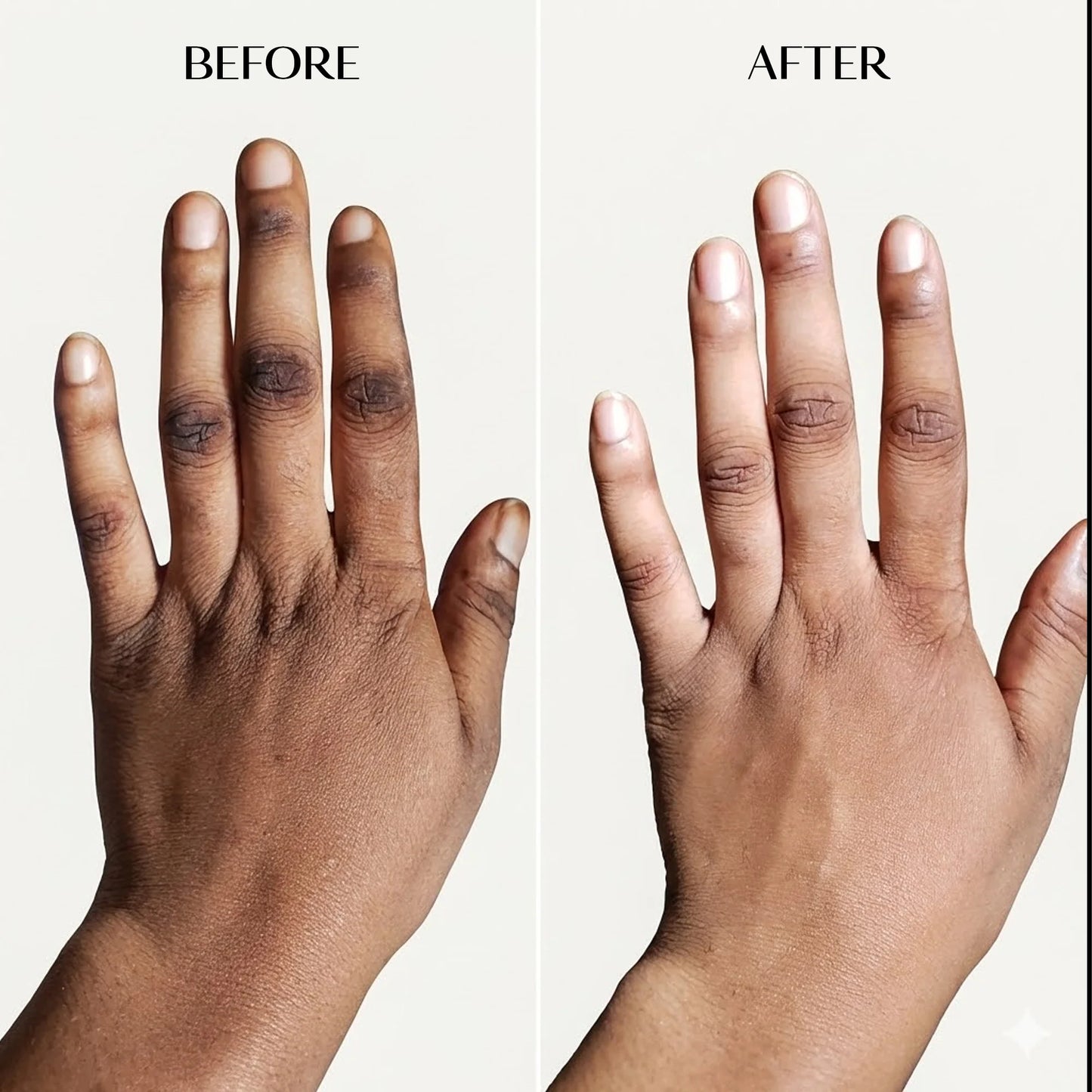 Melanin Dark Spot Corrector