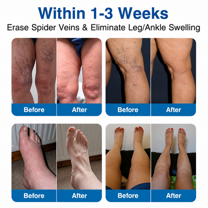 🇺🇸🥇🏆Ladyscart® VeinRepair Microneedle Patch Roll⚡Instant Relief, Long-Term Results