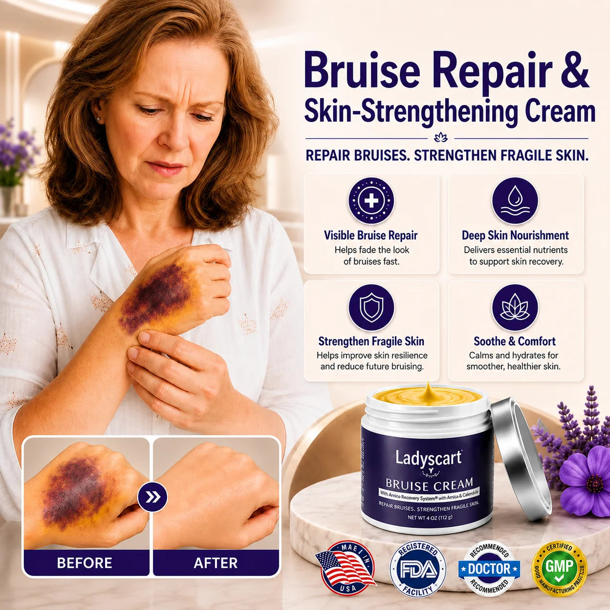 💥75K+ Sold💕 Ladyscart® Bruise Repair Cream | Soothe Bruises & Strengthen Fragile Skin