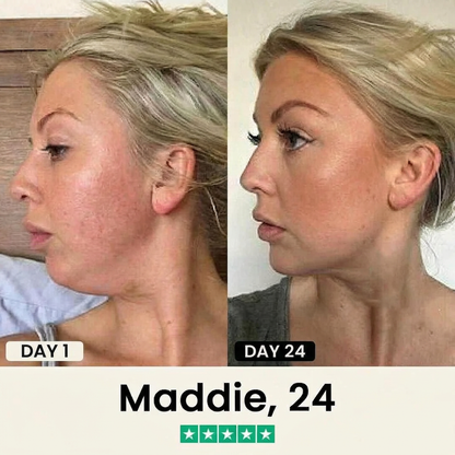 Hoygi Silhouette Refiner Double Chin Lifting Mask