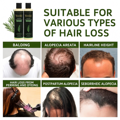 Yonki Rosemary Shampoo, Stimulate Regrowth for Thick Voluminous Hair