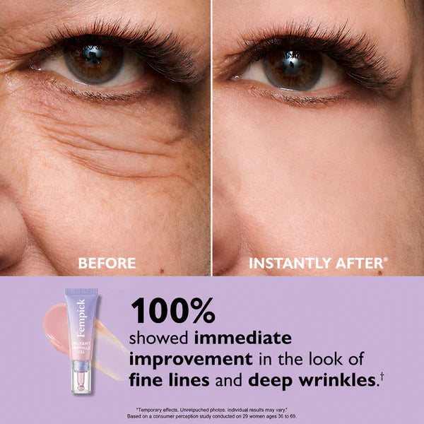 Ladyscart Eye Bag Instant Eraser, Tightens, Firms, & Blurs Wrinkles