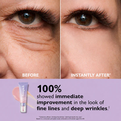 Ladyscart Eye Bag Instant Eraser, Tightens, Firms, & Blurs Wrinkles