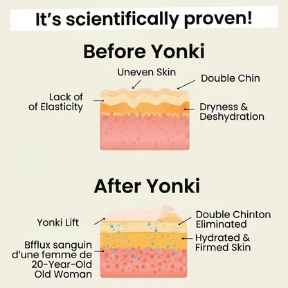 Yonki Silhouette Refiner Double Chin Lifting Mask