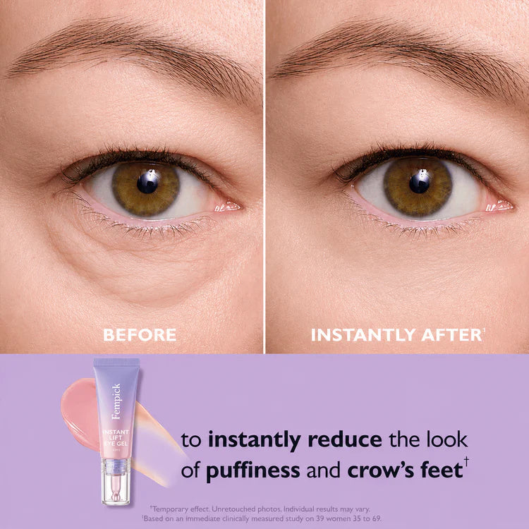 Ladyscart Eye Bag Instant Eraser, Tightens, Firms, & Blurs Wrinkles