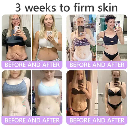 𝑶𝒇𝒇𝒊𝒄𝒊𝒂𝒍 𝑺𝒕𝒐𝒓𝒆| 𝐋𝐚𝐝𝐲𝐬𝐜𝐚𝐫𝐭® 𝐏𝐃𝐑𝐍 𝐌𝐮𝐥𝐭𝐢-𝐏𝐞𝐩𝐭𝐢𝐝𝐞 𝐌𝐚𝐬𝐬𝐚𝐠𝐢𝐧𝐠 𝐁𝐨𝐝𝐲 𝐑𝐨𝐥𝐥𝐞𝐫 𝐂𝐫𝐞𝐚𝐦-Anti-aging, Hydrating, Skin Firming & Lifting, Skin Repair, Even Tone, Acne and Dark Spot Treatment, Wart and Mole Removal, and Psoriasis Relief