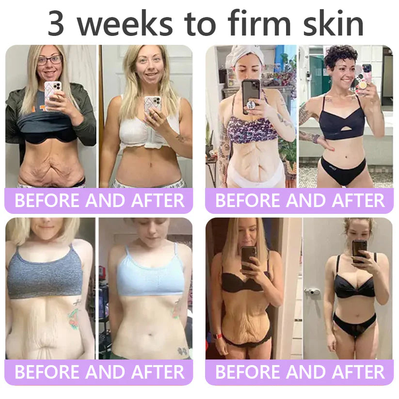 𝑶𝒇𝒇𝒊𝒄𝒊𝒂𝒍 𝑺𝒕𝒐𝒓𝒆| 𝐋𝐚𝐝𝐲𝐬𝐜𝐚𝐫𝐭® 𝐏𝐃𝐑𝐍 𝐌𝐮𝐥𝐭𝐢-𝐏𝐞𝐩𝐭𝐢𝐝𝐞 𝐌𝐚𝐬𝐬𝐚𝐠𝐢𝐧𝐠 𝐁𝐨𝐝𝐲 𝐑𝐨𝐥𝐥𝐞𝐫 𝐂𝐫𝐞𝐚𝐦-Anti-aging, Hydrating, Skin Firming & Lifting, Skin Repair, Even Tone, Acne and Dark Spot Treatment, Wart and Mole Removal, and Psoriasis Relief
