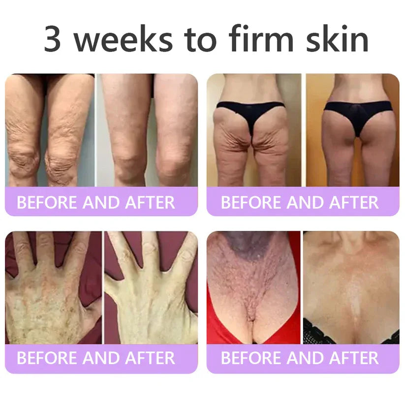 𝑶𝒇𝒇𝒊𝒄𝒊𝒂𝒍 𝑺𝒕𝒐𝒓𝒆| 𝐋𝐚𝐝𝐲𝐬𝐜𝐚𝐫𝐭® 𝐏𝐃𝐑𝐍 𝐌𝐮𝐥𝐭𝐢-𝐏𝐞𝐩𝐭𝐢𝐝𝐞 𝐌𝐚𝐬𝐬𝐚𝐠𝐢𝐧𝐠 𝐁𝐨𝐝𝐲 𝐑𝐨𝐥𝐥𝐞𝐫 𝐂𝐫𝐞𝐚𝐦-Anti-aging, Hydrating, Skin Firming & Lifting, Skin Repair, Even Tone, Acne and Dark Spot Treatment, Wart and Mole Removal, and Psoriasis Relief