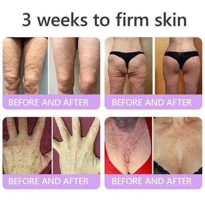 𝑶𝒇𝒇𝒊𝒄𝒊𝒂𝒍 𝑺𝒕𝒐𝒓𝒆| 𝐋𝐚𝐝𝐲𝐬𝐜𝐚𝐫𝐭® 𝐏𝐃𝐑𝐍 𝐌𝐮𝐥𝐭𝐢-𝐏𝐞𝐩𝐭𝐢𝐝𝐞 𝐌𝐚𝐬𝐬𝐚𝐠𝐢𝐧𝐠 𝐁𝐨𝐝𝐲 𝐑𝐨𝐥𝐥𝐞𝐫 𝐂𝐫𝐞𝐚𝐦-Anti-aging, Hydrating, Skin Firming & Lifting, Skin Repair, Even Tone, Acne and Dark Spot Treatment, Wart and Mole Removal, and Psoriasis Relief