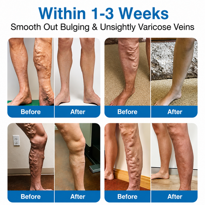 🇺🇸🥇🏆Ladyscart® VeinRepair Microneedle Patch Roll⚡Instant Relief, Long-Term Results