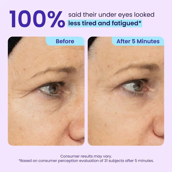 Ladyscart Eye Bag Instant Eraser, Tightens, Firms, & Blurs Wrinkles