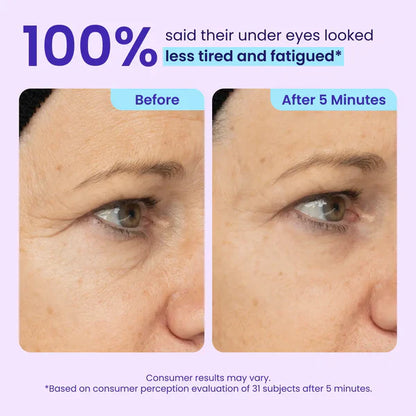 Ladyscart Eye Bag Instant Eraser, Tightens, Firms, & Blurs Wrinkles