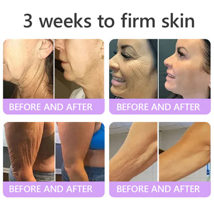 𝑶𝒇𝒇𝒊𝒄𝒊𝒂𝒍 𝑺𝒕𝒐𝒓𝒆| 𝐋𝐚𝐝𝐲𝐬𝐜𝐚𝐫𝐭® 𝐏𝐃𝐑𝐍 𝐌𝐮𝐥𝐭𝐢-𝐏𝐞𝐩𝐭𝐢𝐝𝐞 𝐌𝐚𝐬𝐬𝐚𝐠𝐢𝐧𝐠 𝐁𝐨𝐝𝐲 𝐑𝐨𝐥𝐥𝐞𝐫 𝐂𝐫𝐞𝐚𝐦-Anti-aging, Hydrating, Skin Firming & Lifting, Skin Repair, Even Tone, Acne and Dark Spot Treatment, Wart and Mole Removal, and Psoriasis Relief