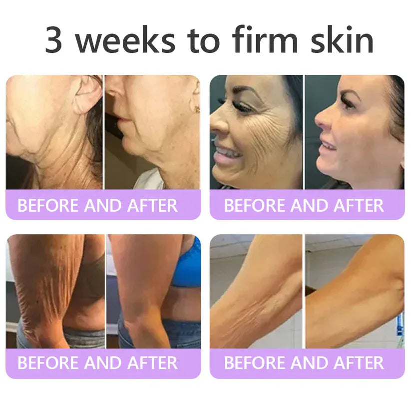 𝑶𝒇𝒇𝒊𝒄𝒊𝒂𝒍 𝑺𝒕𝒐𝒓𝒆| 𝐋𝐚𝐝𝐲𝐬𝐜𝐚𝐫𝐭® 𝐏𝐃𝐑𝐍 𝐌𝐮𝐥𝐭𝐢-𝐏𝐞𝐩𝐭𝐢𝐝𝐞 𝐌𝐚𝐬𝐬𝐚𝐠𝐢𝐧𝐠 𝐁𝐨𝐝𝐲 𝐑𝐨𝐥𝐥𝐞𝐫 𝐂𝐫𝐞𝐚𝐦-Anti-aging, Hydrating, Skin Firming & Lifting, Skin Repair, Even Tone, Acne and Dark Spot Treatment, Wart and Mole Removal, and Psoriasis Relief