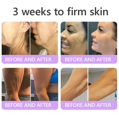 𝑶𝒇𝒇𝒊𝒄𝒊𝒂𝒍 𝑺𝒕𝒐𝒓𝒆| 𝐋𝐚𝐝𝐲𝐬𝐜𝐚𝐫𝐭® 𝐏𝐃𝐑𝐍 𝐌𝐮𝐥𝐭𝐢-𝐏𝐞𝐩𝐭𝐢𝐝𝐞 𝐌𝐚𝐬𝐬𝐚𝐠𝐢𝐧𝐠 𝐁𝐨𝐝𝐲 𝐑𝐨𝐥𝐥𝐞𝐫 𝐂𝐫𝐞𝐚𝐦-Anti-aging, Hydrating, Skin Firming & Lifting, Skin Repair, Even Tone, Acne and Dark Spot Treatment, Wart and Mole Removal, and Psoriasis Relief