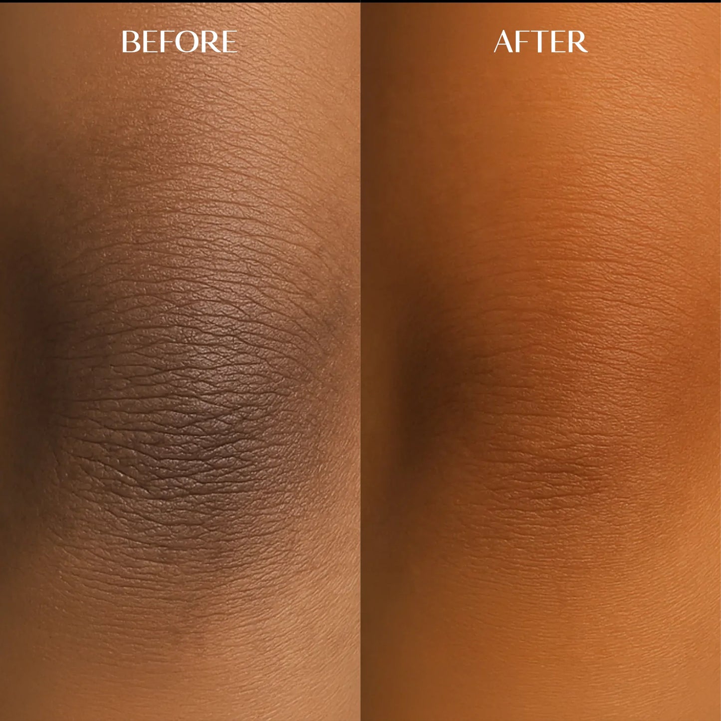 Melanin Dark Spot Corrector