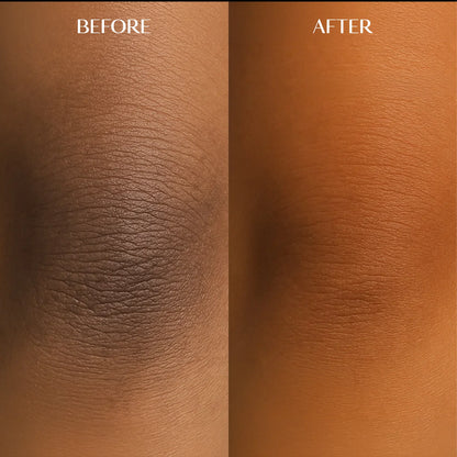 Melanin Dark Spot Corrector