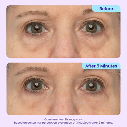Ladyscart Eye Bag Instant Eraser, Tightens, Firms, & Blurs Wrinkles