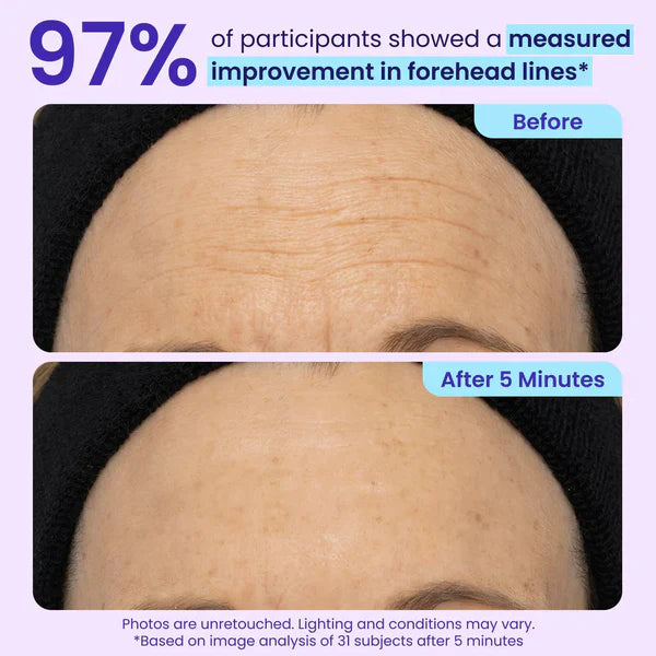 Ladyscart Eye Bag Instant Eraser, Tightens, Firms, & Blurs Wrinkles