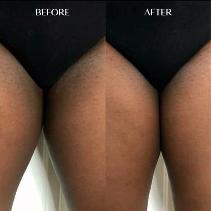 Melanin Dark Spot Corrector