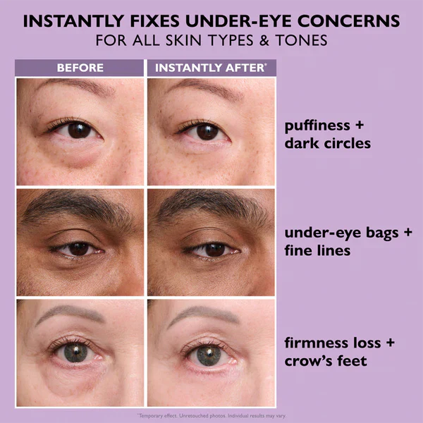 Ladyscart Eye Bag Instant Eraser, Tightens, Firms, & Blurs Wrinkles