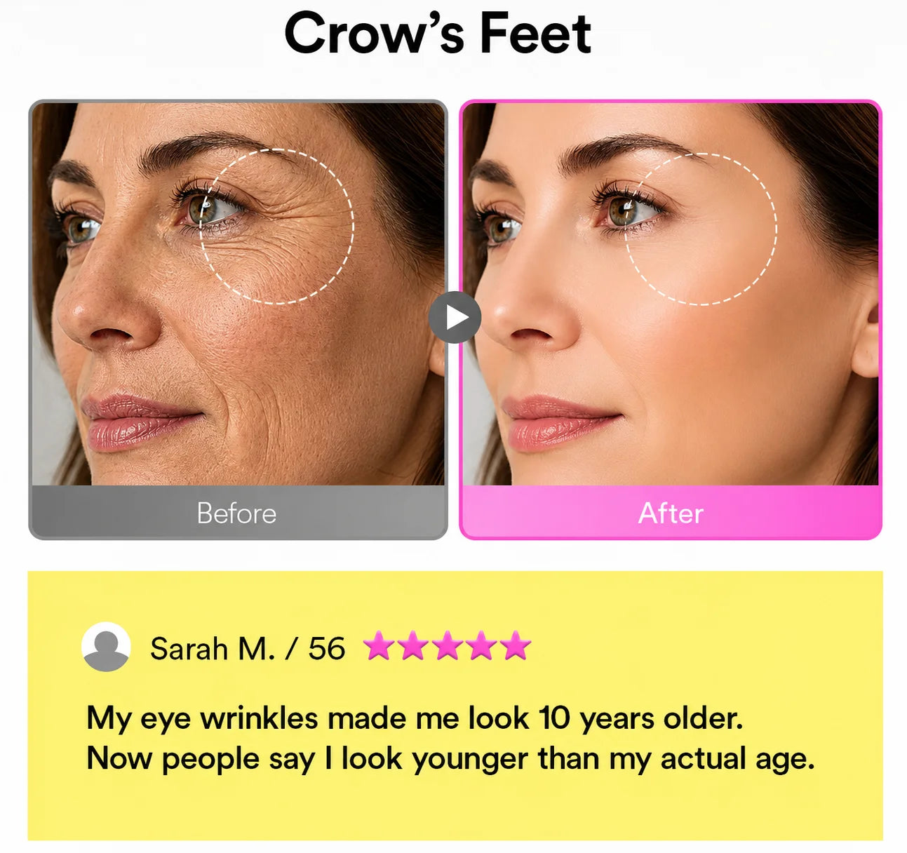 Ladyscart® Eye Care: Maximum Strength Against Bags & Dark Circles, 100% Gentle 🛡️💖