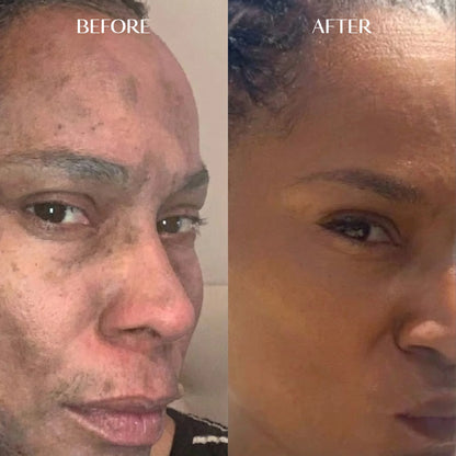 Melanin Dark Spot Corrector