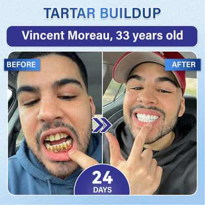 Ladyscart Tooth & Gum Repair Fast-Dissolving Microneedle Patch✨ (𝟓-𝐢𝐧-𝟏 💎 𝐑𝐞𝐛𝐮𝐢𝐥𝐝 𝐄𝐧𝐚𝐦𝐞𝐥 & 𝐃𝐞𝐧𝐭𝐢𝐧 • 𝐒𝐭𝐫𝐞𝐧𝐠𝐭𝐡𝐞𝐧 𝐆𝐮𝐦𝐬 • 𝐄𝐫𝐚𝐝𝐢𝐜𝐚𝐭𝐞 𝐓𝐚𝐫𝐭𝐚𝐫 & 𝐎𝐝𝐨𝐫 • 𝐖𝐡𝐢𝐭𝐞𝐧𝐢𝐧𝐠 • 𝐒𝐭𝐨𝐩 𝐓𝐨𝐨𝐭𝐡 𝐒𝐞𝐧𝐬𝐢𝐭𝐢𝐯𝐢𝐭𝐲)