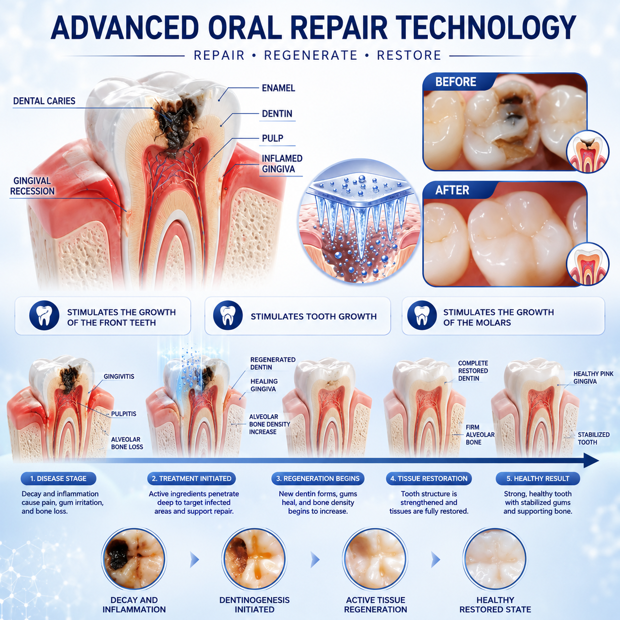 Ladyscart Tooth & Gum Repair Fast-Dissolving Microneedle Patch✨ (𝟓-𝐢𝐧-𝟏 💎 𝐑𝐞𝐛𝐮𝐢𝐥𝐝 𝐄𝐧𝐚𝐦𝐞𝐥 & 𝐃𝐞𝐧𝐭𝐢𝐧 • 𝐒𝐭𝐫𝐞𝐧𝐠𝐭𝐡𝐞𝐧 𝐆𝐮𝐦𝐬 • 𝐄𝐫𝐚𝐝𝐢𝐜𝐚𝐭𝐞 𝐓𝐚𝐫𝐭𝐚𝐫 & 𝐎𝐝𝐨𝐫 • 𝐖𝐡𝐢𝐭𝐞𝐧𝐢𝐧𝐠 • 𝐒𝐭𝐨𝐩 𝐓𝐨𝐨𝐭𝐡 𝐒𝐞𝐧𝐬𝐢𝐭𝐢𝐯𝐢𝐭𝐲)
