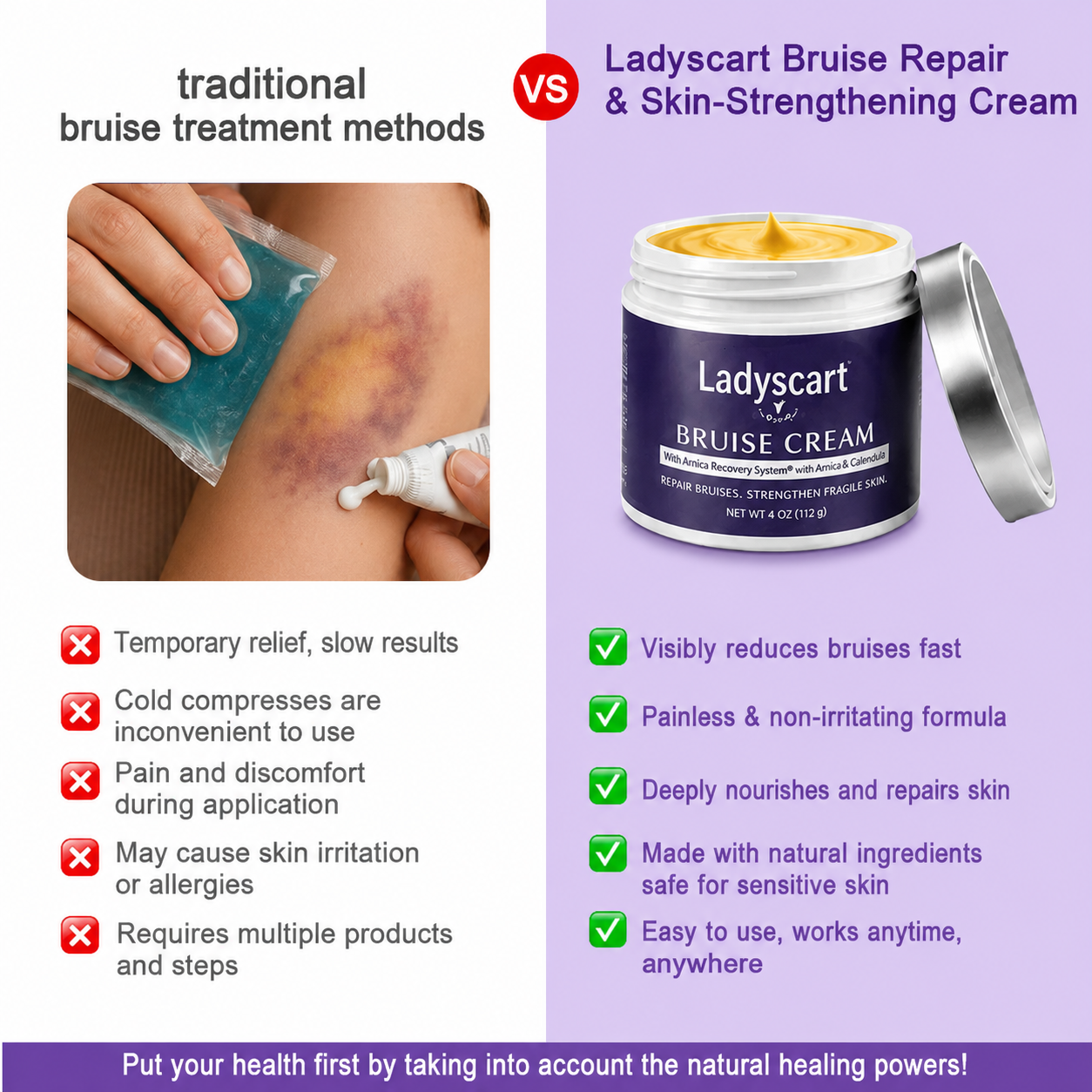 💥75K+ Sold💕 Ladyscart® Bruise Repair Cream | Soothe Bruises & Strengthen Fragile Skin