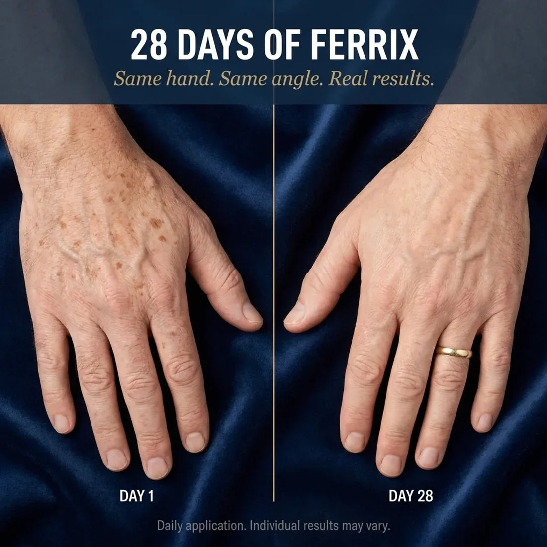 DERMAX Age Spot Corrector