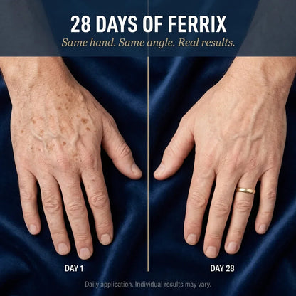 DERMAX Age Spot Corrector