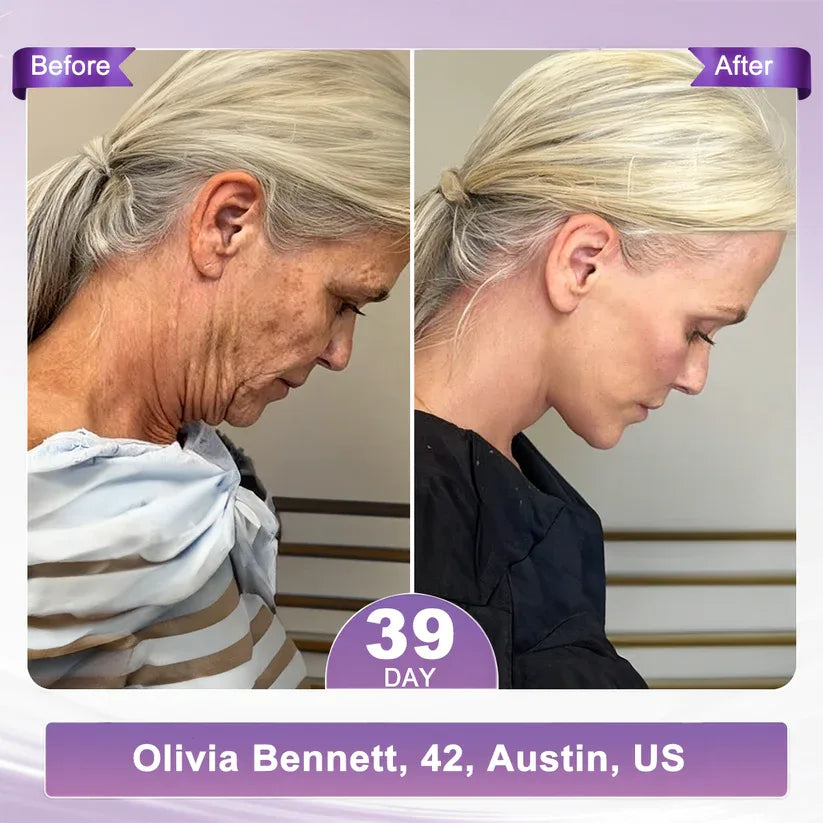 𝑶𝒇𝒇𝒊𝒄𝒊𝒂𝒍 𝑺𝒕𝒐𝒓𝒆| 𝐋𝐚𝐝𝐲𝐬𝐜𝐚𝐫𝐭® 𝐏𝐃𝐑𝐍 𝐌𝐮𝐥𝐭𝐢-𝐏𝐞𝐩𝐭𝐢𝐝𝐞 𝐌𝐚𝐬𝐬𝐚𝐠𝐢𝐧𝐠 𝐁𝐨𝐝𝐲 𝐑𝐨𝐥𝐥𝐞𝐫 𝐂𝐫𝐞𝐚𝐦-Anti-aging, Hydrating, Skin Firming & Lifting, Skin Repair, Even Tone, Acne and Dark Spot Treatment, Wart and Mole Removal, and Psoriasis Relief